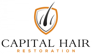 Hair transplant in London with Capilar Hair restoration
