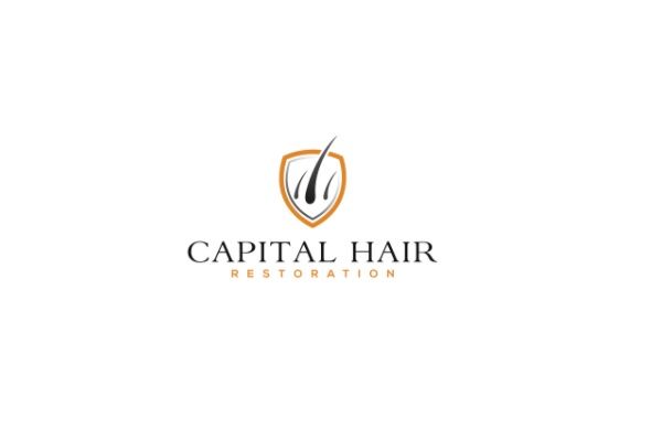 Capital Hair Restoration Reviews