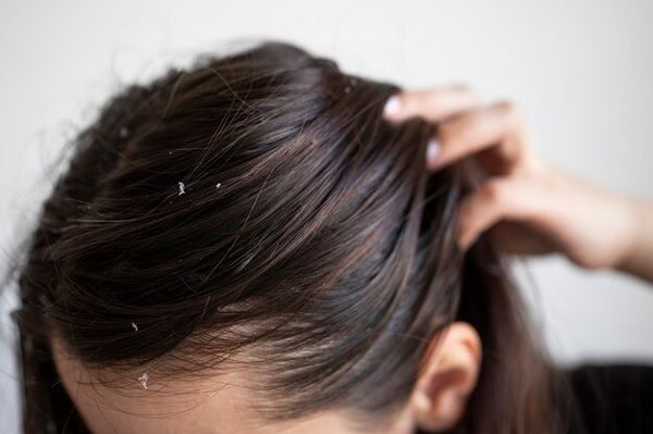 Oil on your scalp cause hair loss