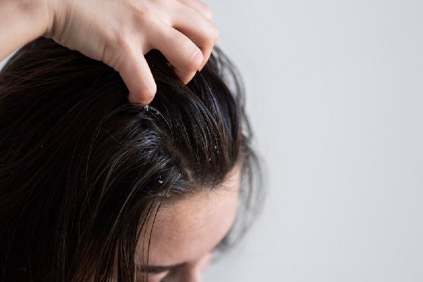 Oil on your scalp cause hair loss