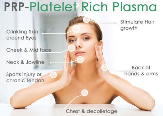 Platelet-rich plasma (PRP) injections