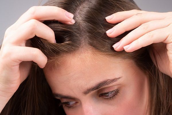 Hair transplant for frontal alopecia in women