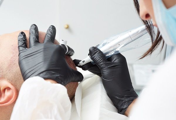 The Shaving Effect of Tricopigmentation