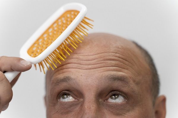 Hair transplant countries