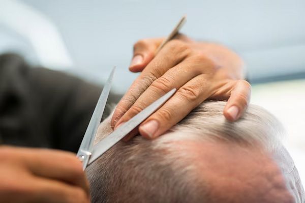 Tips for cutting hair after a hair transplant1