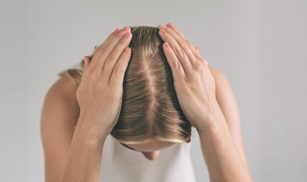 Shock loss after hair transplant