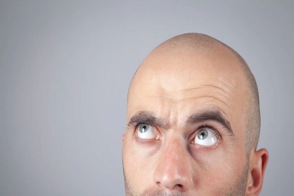 Shock Loss After Hair Transplant