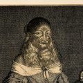 What Is Hypertrichosis?