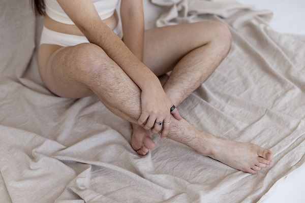 What Is Hormonal Hirsutism?