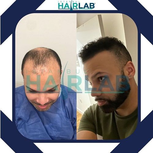 Anatolia Hair Clinic Image