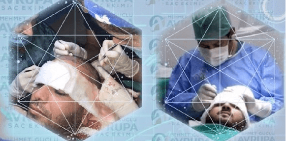 Avrupa Sac Ekimi Clinic Image