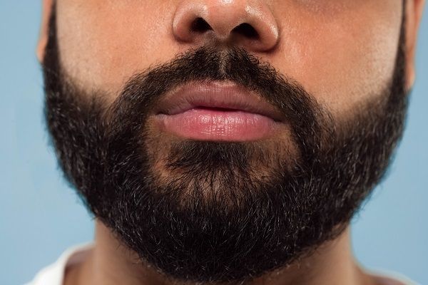 Young man with beard Transformation through FUE Method