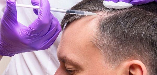 Mesotherapy Mondes Clinic Services