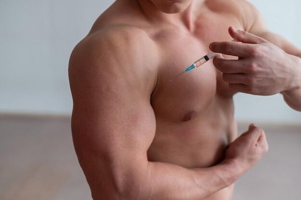 Anabolic steroids and alopecia