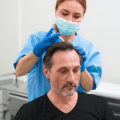 Suitable for A Hair Transplant
