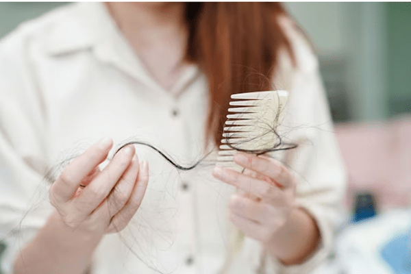 Genes That Cause Alopecia