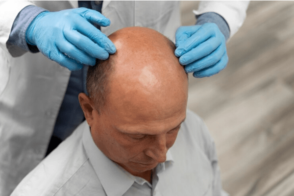 Gym After Hair Transplant