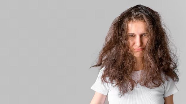 How to recover burned hair