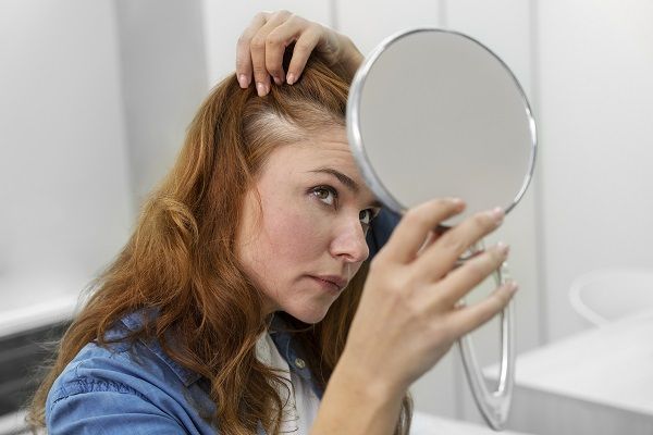 Seborrheic dermatitis