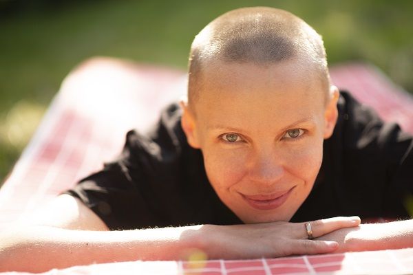Hair Loss Due to Chemotherapy