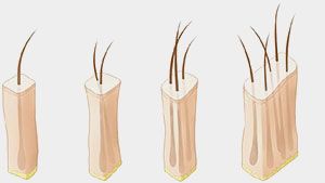 Follicular unit grafs