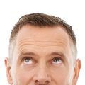 Mature hairline