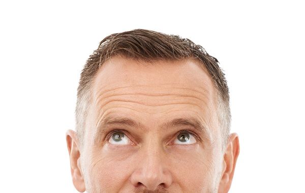 Mature hairline