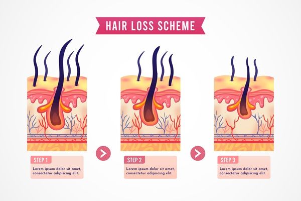 Hair loss scheme