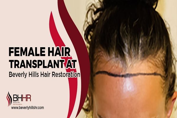 Beverly Hills Hair Restoration (BHHR)