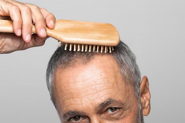 Finasteride for hair loss