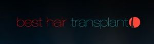 Hair Transplants Los Angeles