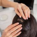Top 10 hair transplant clinics in California