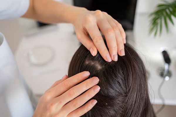Top 10 hair transplant clinics in California