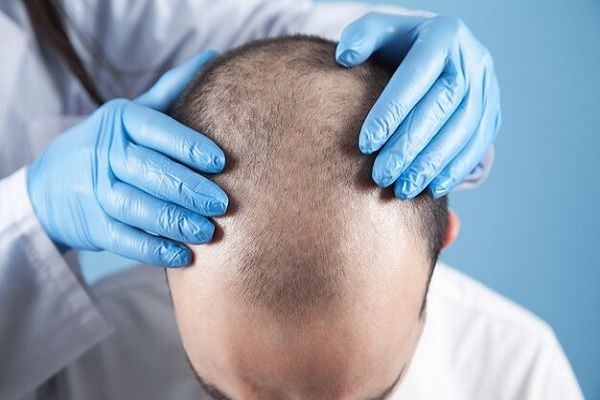 Top 10 hair transplant clinics in Dubai