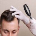 Top 10 hair transplant clinics in NYC
