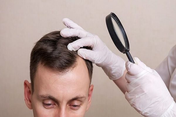 Top 10 hair transplant clinics in NYC