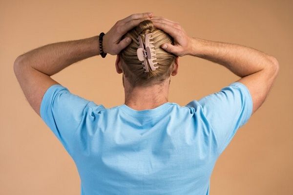 Causes of traction alopecia