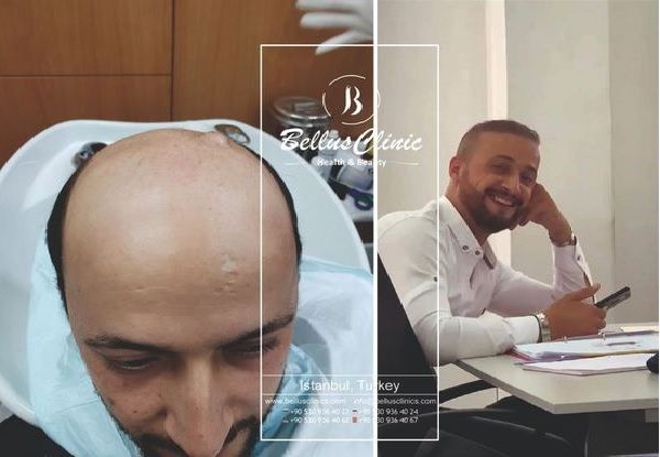Bellus Clinic