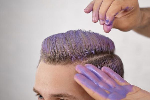 Mann färbt seine Haare lila, um die verschiedenen Haarfarbenoptionen nach einer Haartransplantation darzustellen