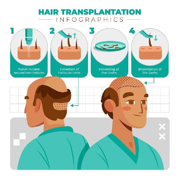 Evolution der Haartransplantation 1
