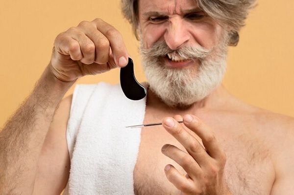 Folliculitis decalvans