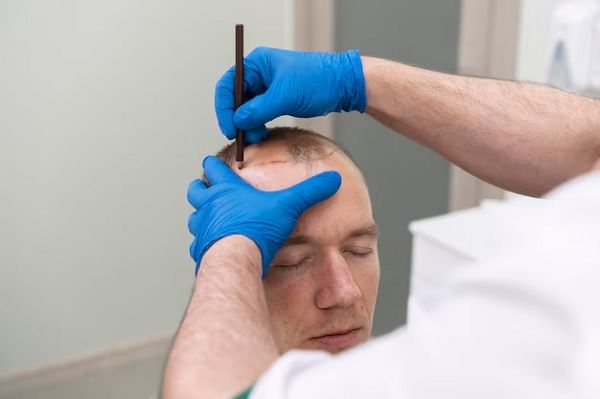 Haartransplantat-Abstoßung 1