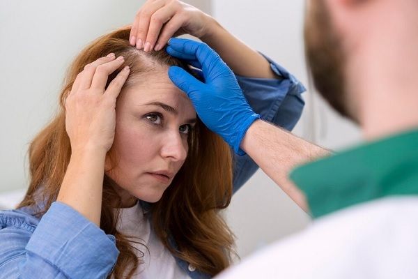 Haartransplantation an der Stirn für Frauen 1