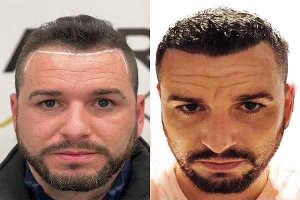 HairBack Clinic