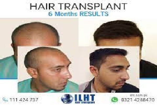 ILHT 1