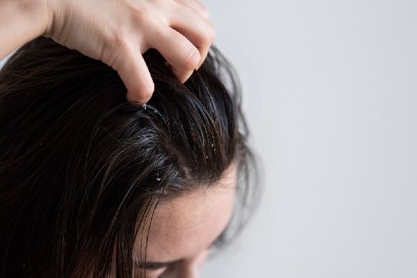 Öl auf der Kopfhaut Haarausfall 2