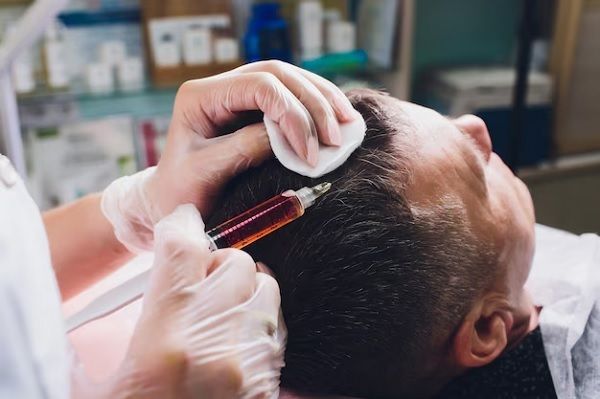 Patienten, die nicht für eine Haartransplantation geeignet sind 2