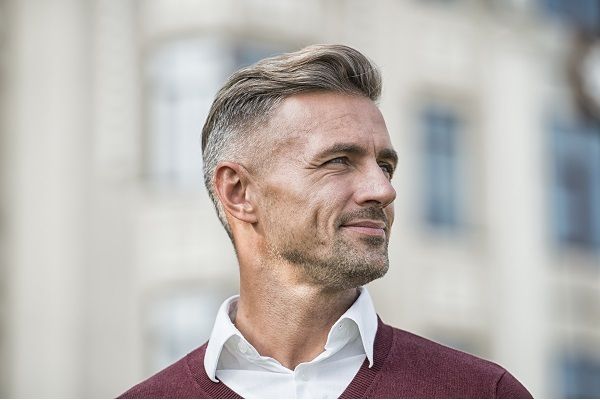 Reife Haarlinie 3