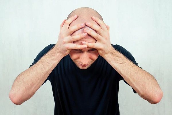 Schockverlust nach Haartransplantation 2