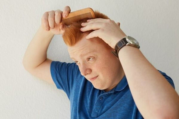 Uncombable hair syndrome 1